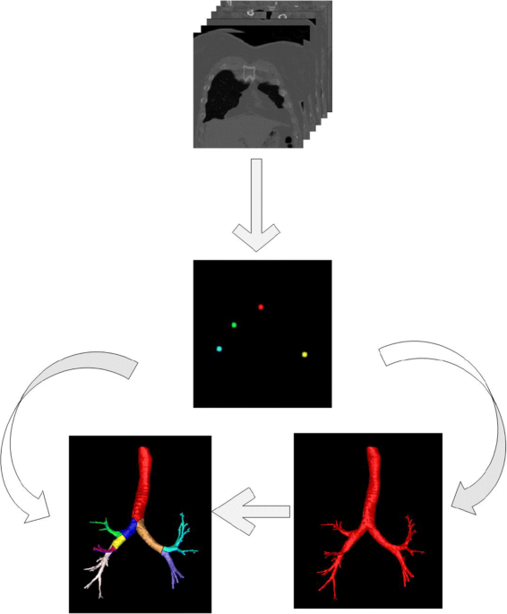 Automated labeling of the airway tree in terms of lobes based on deep learning of bifurcation point detection medical biological engineering puting